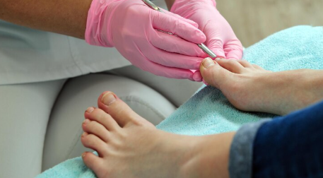 En centros como Podoprevent, los tratamientos se adaptan a cada paciente según el grado de la afección. Puede que solo se necesite un corte adecuado para liberar el borde encarnado, o en casos más avanzados, técnicas como reeducación ungueal - una especie de mini férula blanda para guiar el crecimiento de la uña—. En situaciones crónicas o recurrentes, podemos trabajar interdisciplinariamente con Traumatología que por medio de una cirugía elimina la parte de la uña que se encarna y en podología acompañamos ese tratamiento educando a la nueva uña para evitar que vuelva a encarnarse. Todo con una atención amable, profesional y sin dolor.